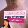 protokół ospa u dzieci Ospa wietrzna jak leczyć