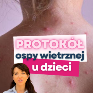Ospa wietrzna jak leczyć